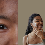 Two photos of a Black women, in one, it's a close-up of her face, and in the other, she's doing skincare to show How to Manage Hormonal Acne During Your Period